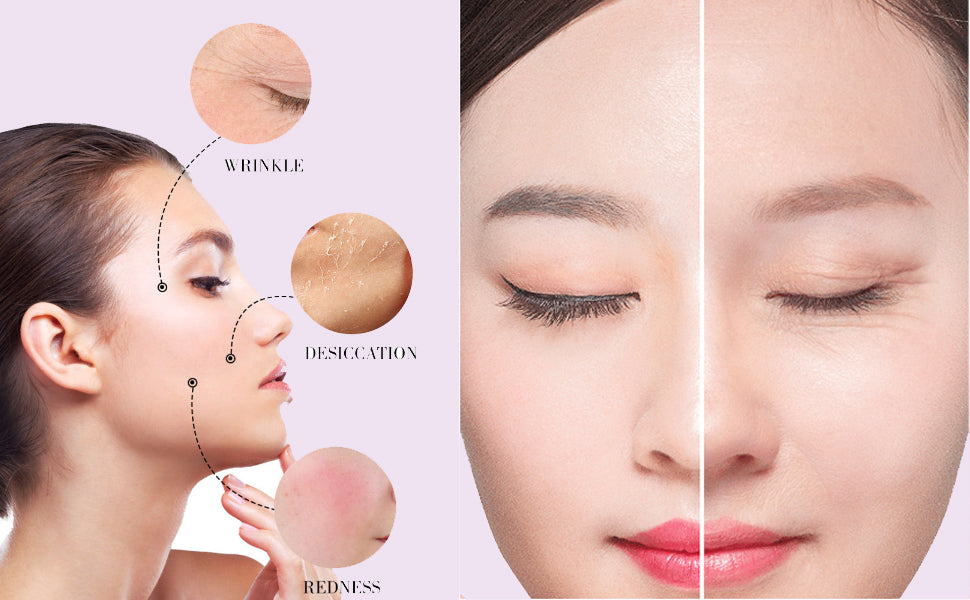 DERMAFiX Perfect Real Performance Vita Collagen Mask 23g x 8ea