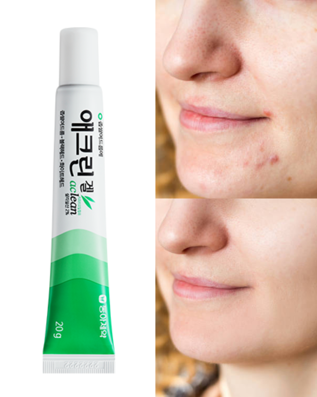 Dong-A Pharm Aclean Gel 20g