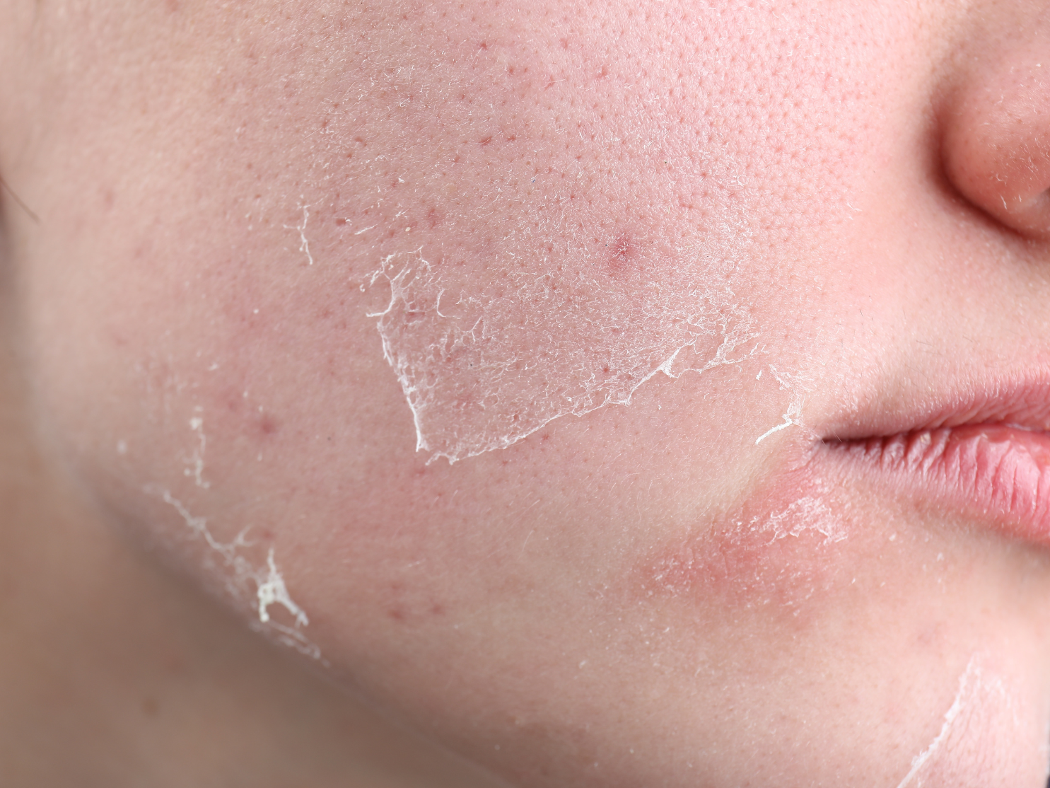 The Ultimate Guide to Luxurious Skincare for Dry Skin - Rejuvenate and Hydrate Your Way to Radiant Beauty
