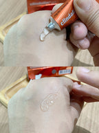 Clindalin gel For Acne 10g