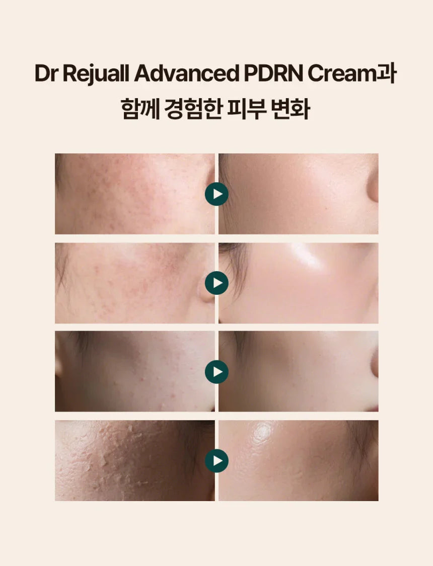 REJUALL 韓國 高階PDRN再生修復霜 20g