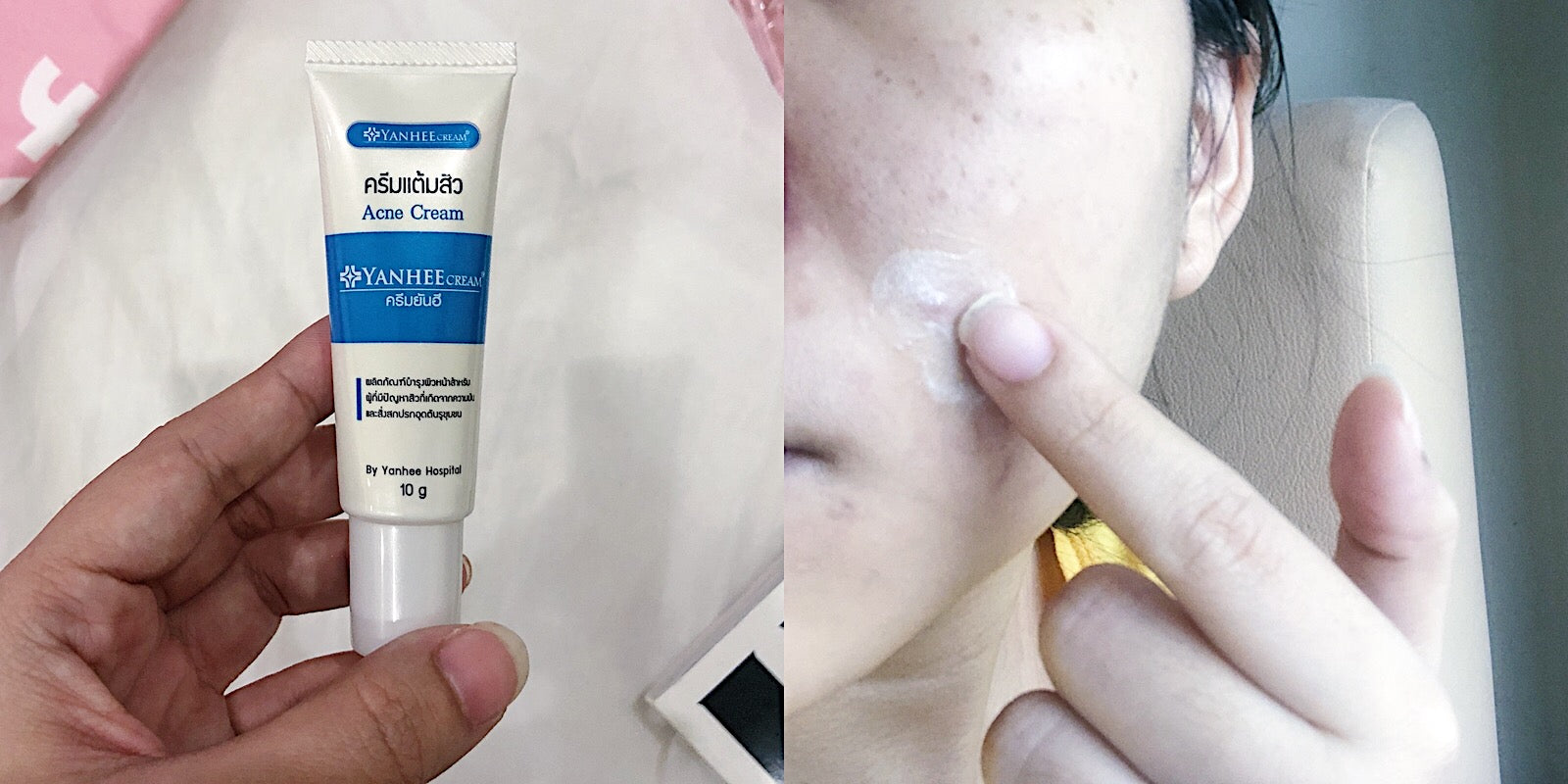 Yanhee Acne Cream 10g