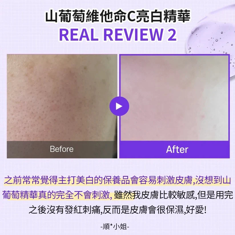 Sungboon 韓國 山葡萄維他命C 煙酰胺亮白淡斑精華 30ml