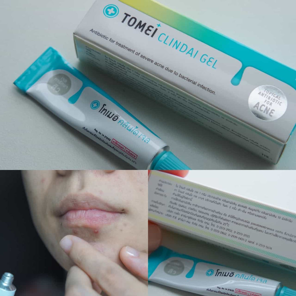 TOMEI Clindai Gel (Topical Antibiotic For Acne) 5g