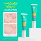 MizuMi B3 Acne Concentrate Serum 13g