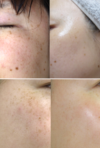 DongSung Pharmaceutical Rannce Cream 70g