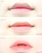 Hanmi Pharmaceutical Procalm Highly Moisturizing Dead Skin Care Lip Essence 12g