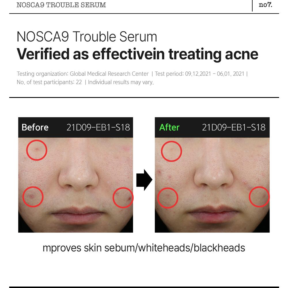 Dong-A Pharm Fation Noscar9 Trouble Serum (Sebum Control) 50ml