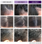 Ru:t Hair AgeLess Clinic Hair Set (Shampoo + Treatment + Ampoule)