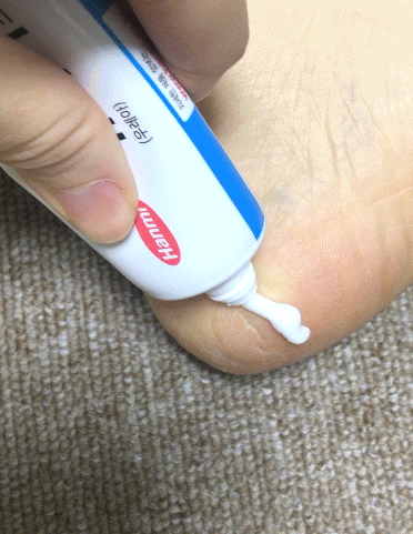 Hanmi 韓國 PRO-CALM 強效醫美手腳裂膏 50g