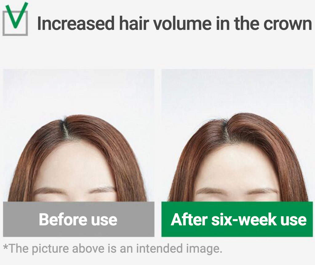 LABO-H 韓國 頭皮強化防脫發益生菌洗髮水 333ml+ 50ml