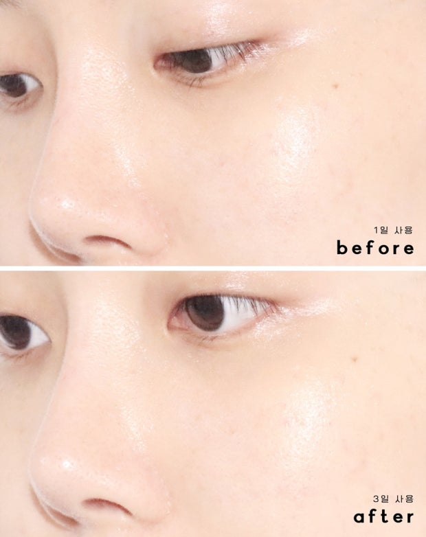 BRING GREEN 韓國 3天速效深層補濕水油雙精華 (保濕) 25ml