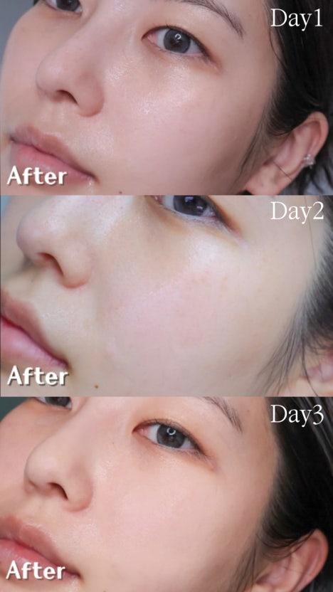 BRING GREEN 韓國 3天速效去黃亮白精華 (美白) 25ml