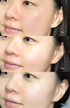 BRING GREEN 韓國 3天速效去黃亮白精華 (美白) 25ml