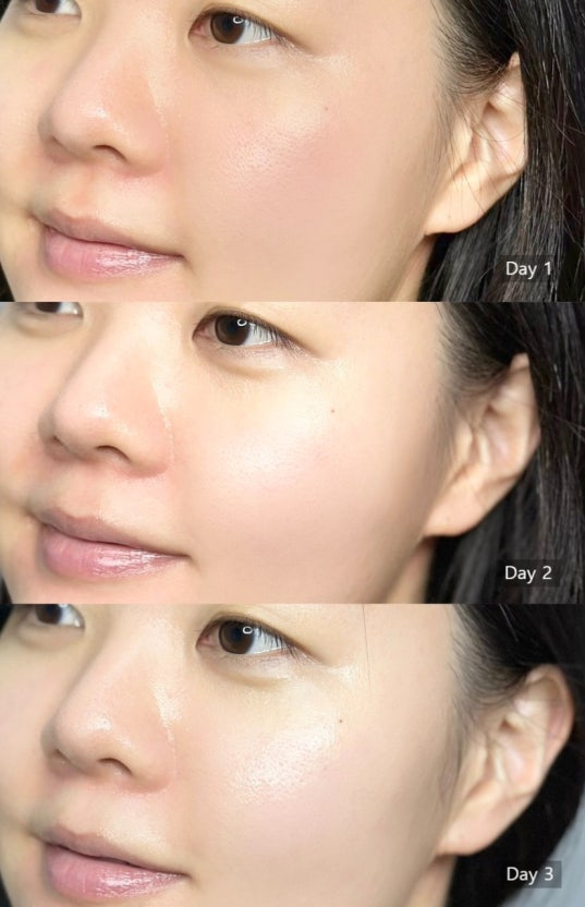 BRING GREEN 韓國 3天速效去黃亮白精華 (美白) 25ml