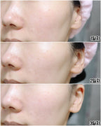 BRING GREEN 韓國 3天速效去黃亮白精華 (美白) 25ml