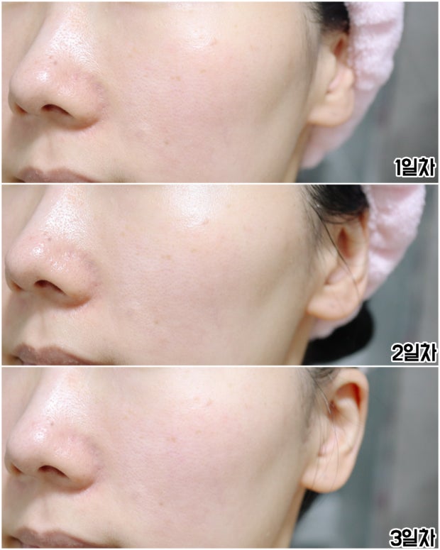 BRING GREEN 韓國 3天速效去黃亮白精華 (美白) 25ml