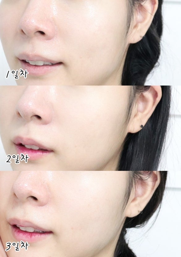 BRING GREEN 韓國 3天速效去黃亮白精華 (美白) 25ml