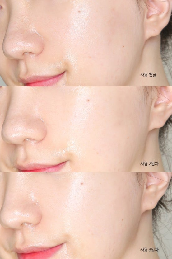 BRING GREEN 韓國 3天速效去黃亮白精華 (美白) 25ml