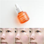 BRING GREEN 韓國 3天速效去黃亮白精華 (美白) 25ml