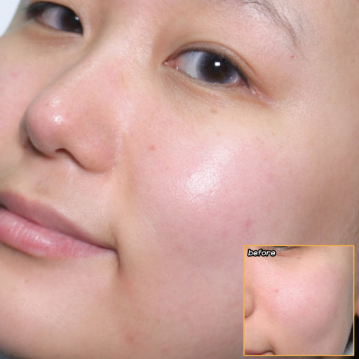 BRING GREEN 韓國 3天速效去黃亮白精華 (美白) 25ml