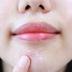 Nots Centella Scar Ointment (Ylang-Ylang) 15ml