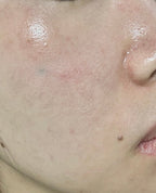 Nots Centella Scar Ointment (Ylang-Ylang) 15ml