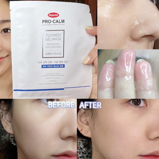 Hanmi Pro-Calm Fusimedi Repair Gel Mask 5 packs / box