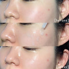 Mediheal 30150 Madecassoside Vitamin C Brightening Serum (Fades Dark Spots) 40ml