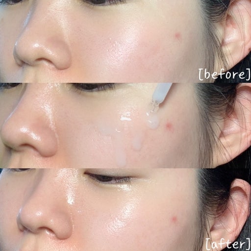 Mediheal 30150 Madecassoside Vitamin C Brightening Serum (Fades Dark Spots) 40ml