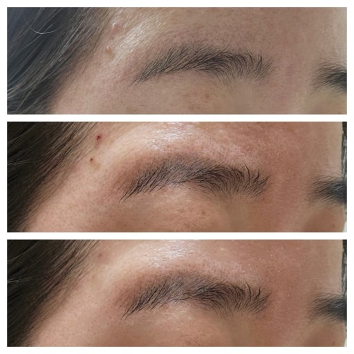 Mediheal 30150 Madecassoside Vitamin C Brightening Serum (Fades Dark Spots) 40ml