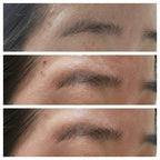 Mediheal 30150 Madecassoside Vitamin C Brightening Serum (Fades Dark Spots) 40ml