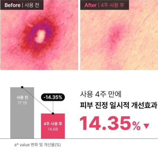 Dong-A Pharm BHA Spot Solution Acne Pro Gel 30ml
