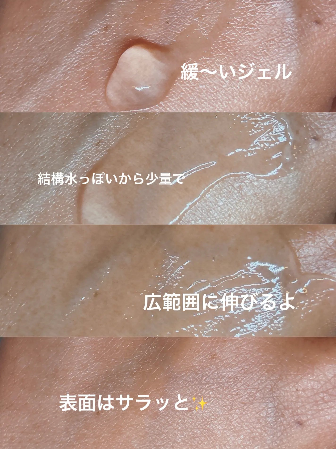 Sevitab Vitamin B3 Skin Treatment Acne Care Gel 18g