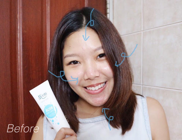 DR. MONTRI Oil Control Facial Foam Cleanser (Big Size) 125g