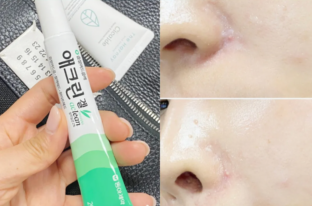 Dong-A Pharm Aclean Gel 20g