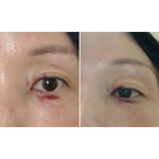 Hanmi PRO CALM Red X Cream (Reduce Dkin Discoloration) 18ml