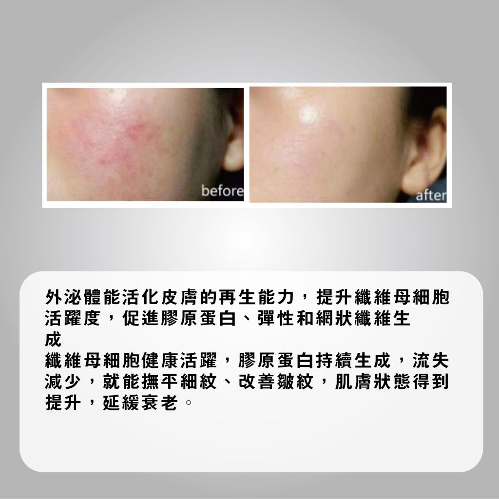 Agafar EXOXEN Skin Reset Booster 3ml