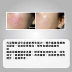 Agafar EXOXEN Skin Reset Booster 3ml