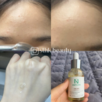 Ample N Acne Shot Ampoule 30ml