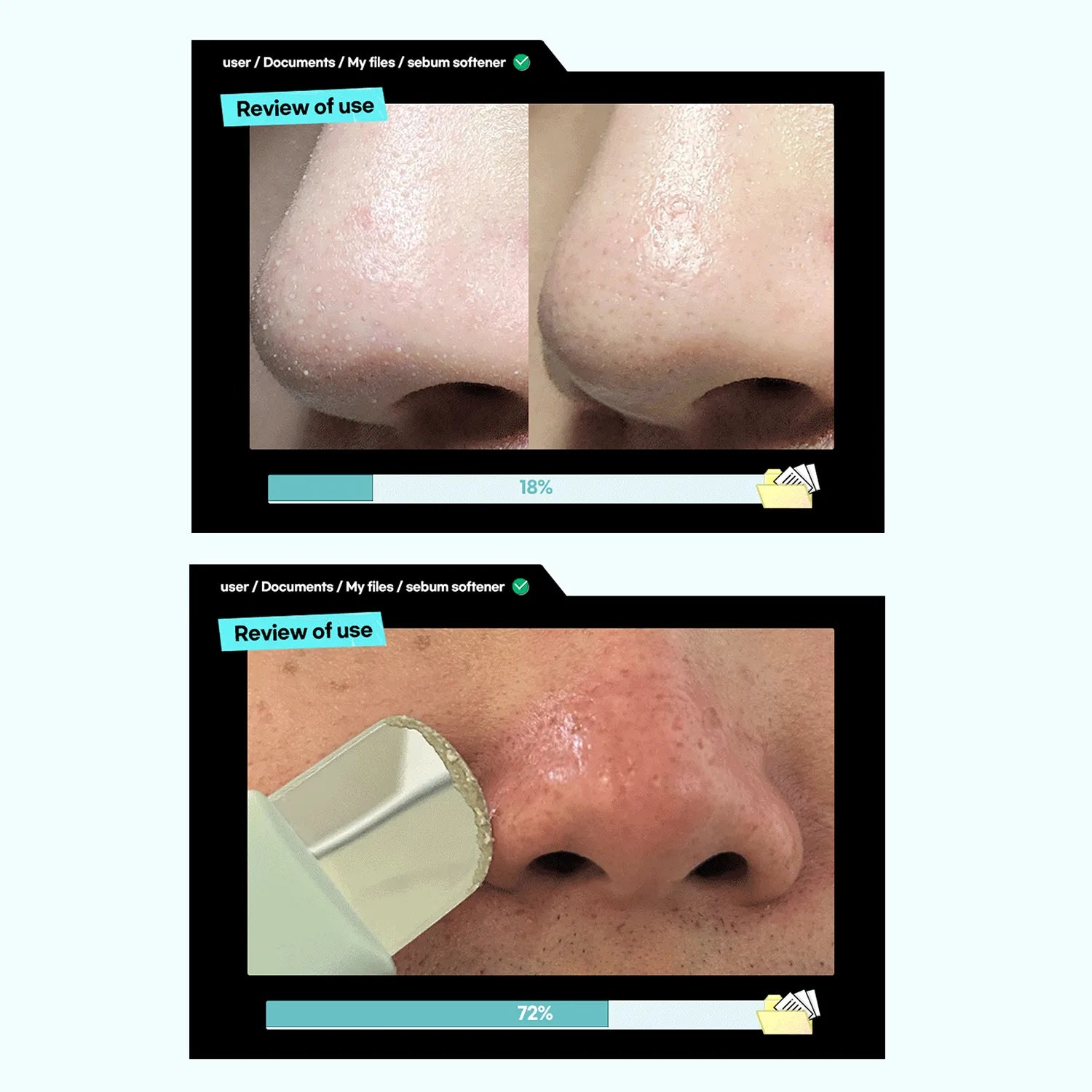 ilso Super Melting Sebum Softener Special Set 150ml (Toner + Cotton Pad 40pcs + Deep Clean Master)