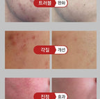 VQM Virexin Premium PDRN Moisturizing Repair Cream 30ml