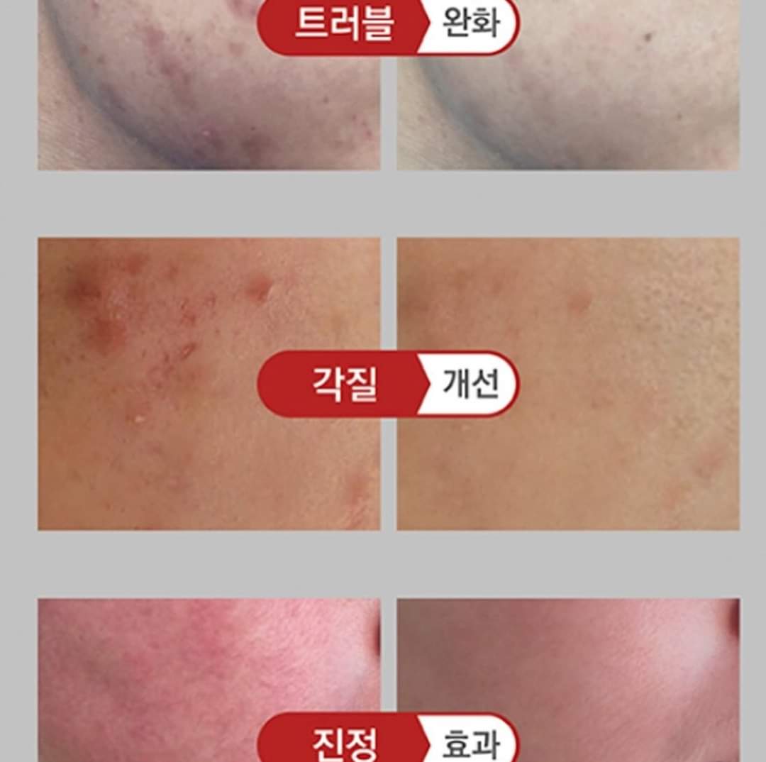 VQM Virexin Premium PDRN Moisturizing Repair Cream 30ml