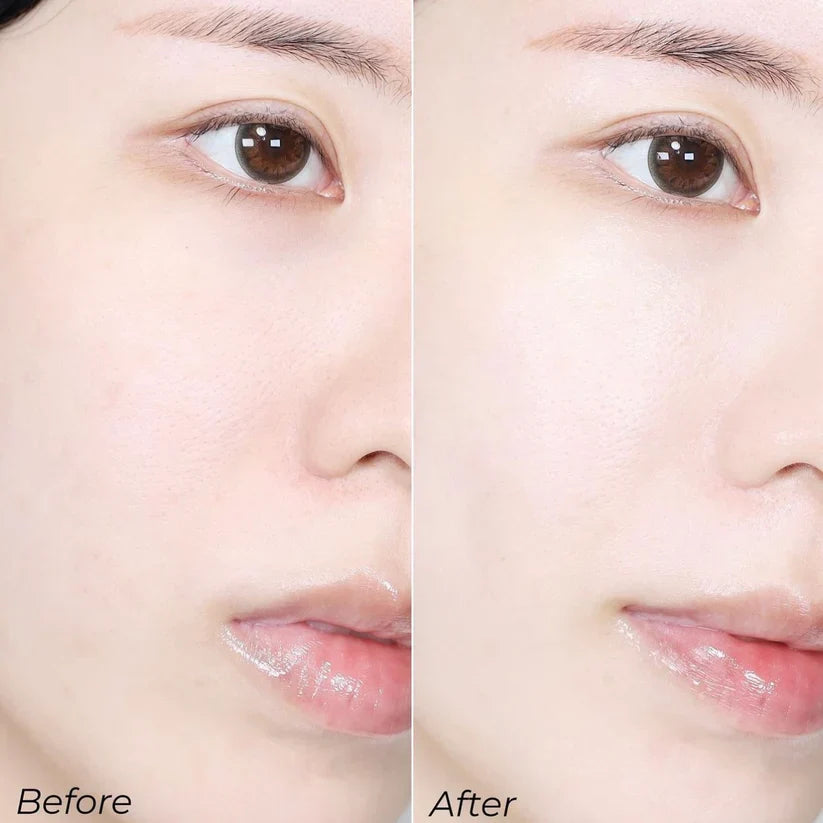 Sungboon Meoru Podo Vita C Dark Spot Ampoule 30ml