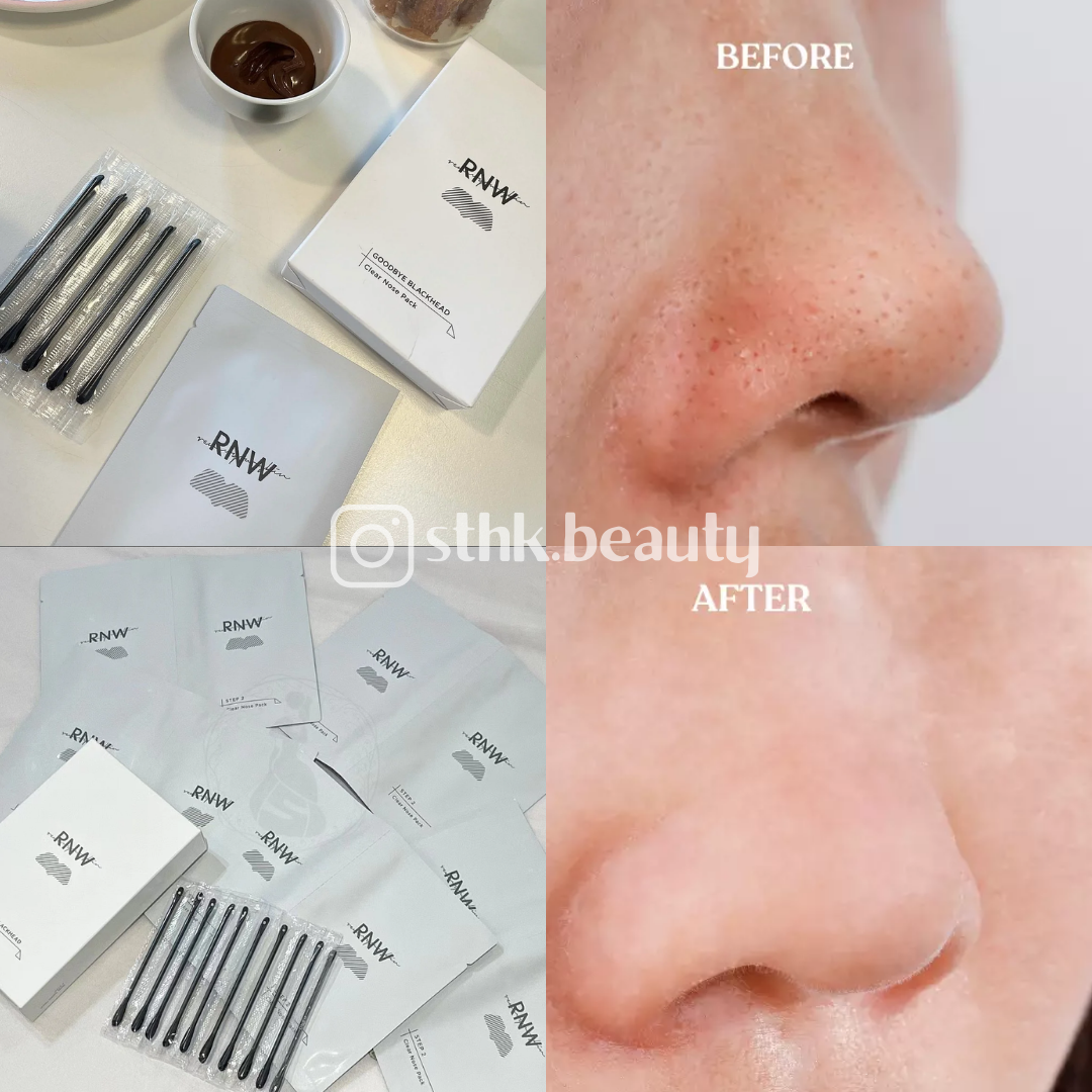 RNW Clear Nose Pack Blackhead Removal Pore Contraction 5sets
