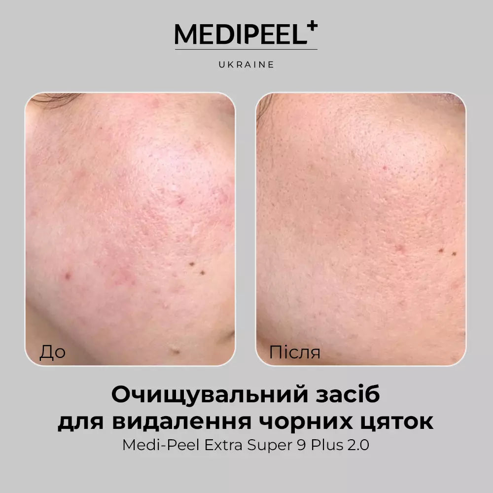 Medipeel Extra Super 9 Plus 2.0 (Upgraded Version) 1000ml