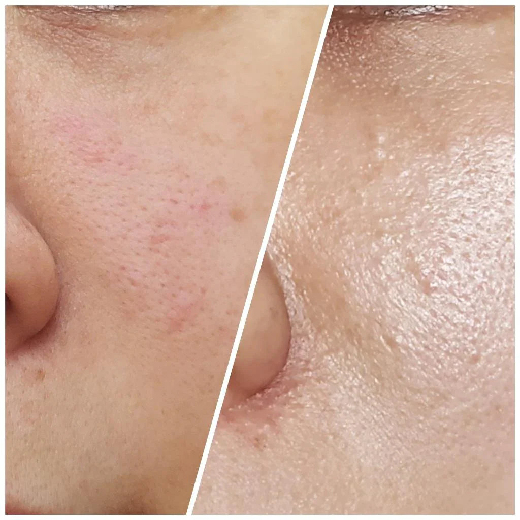 SUNGBOON EDITOR Green Tomato Pore Firming Essence 30ml + 30ml