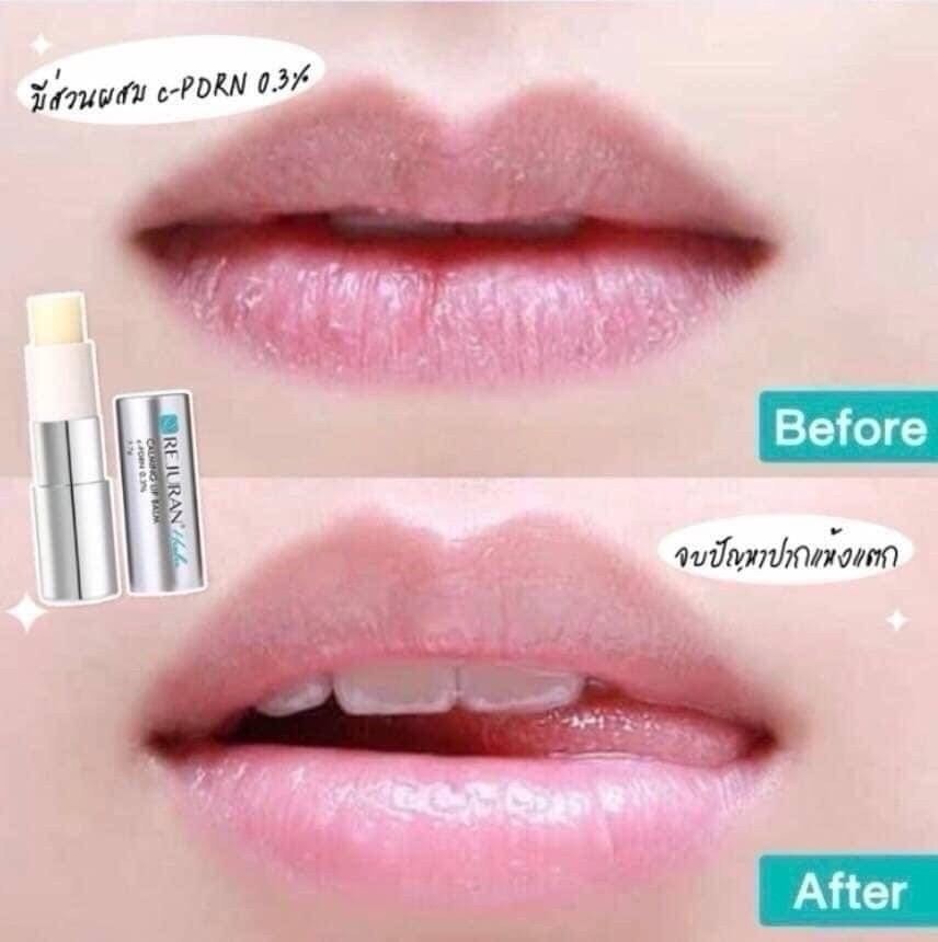 Rejuran 5-in-1 PDRN Calming Repair Lip Balm 3.7g