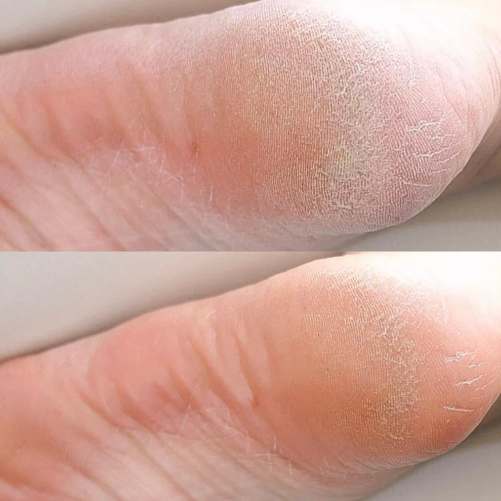 kwangdong Dancua Heeling Peeling Cream 50g