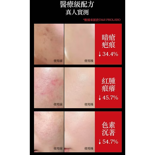 RaimeTHX Collagen Firming Elastic Moisturizing Mask 35ml x 5ea
